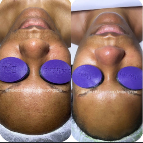 Deep Cleanse 2-Layer Enzyme Facial