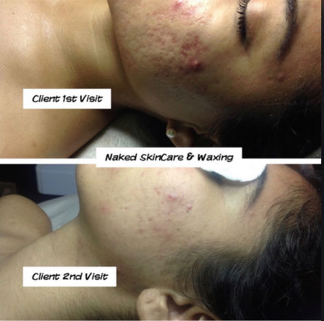 Oil Control & Pore Minimize Facial