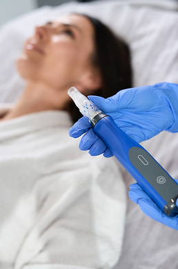 microneedling pen with patient in the background awaiting treatement