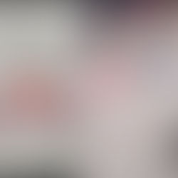 Coração de vítima de acidente com carreta continua a pulsar mesmo fora do corpo