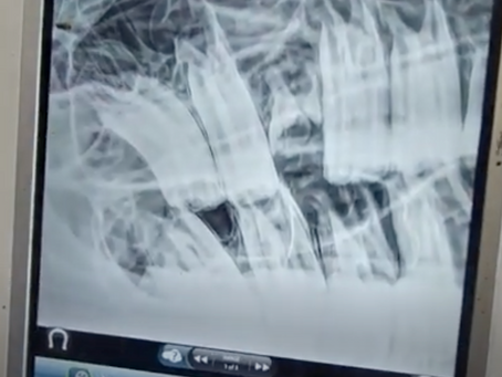 Understanding Sinusitis in Horses: A Case Study