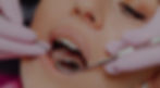 wisdom teeth removal Hawthorn