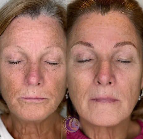 Before and after comparison showing cosmetic tattoo brows creating a fuller, more defined and structured brow shape.