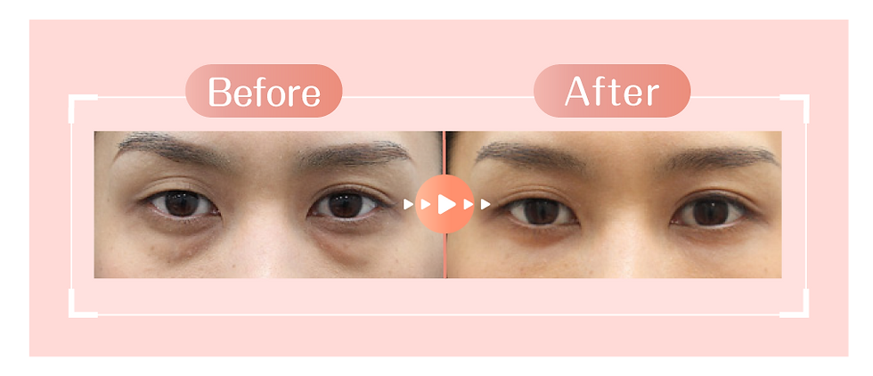 AE_20250807_Eye Fit_新 Landing-14.png