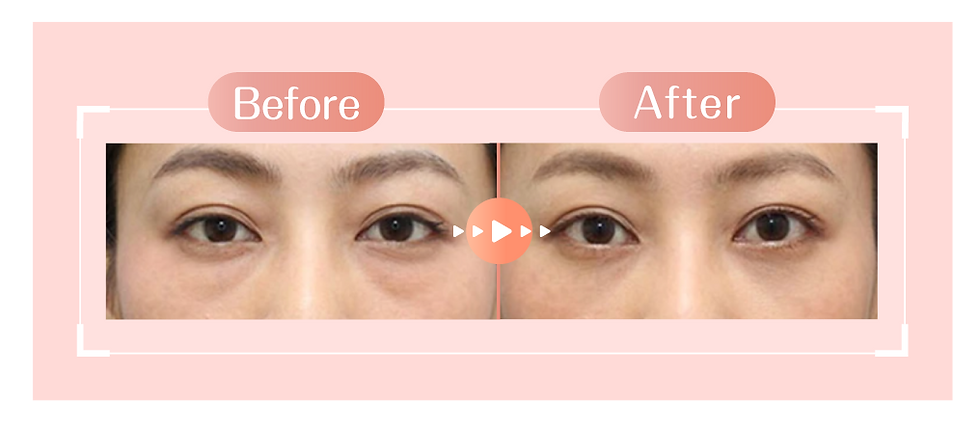 AE_20250807_Eye Fit_新 Landing-22.png