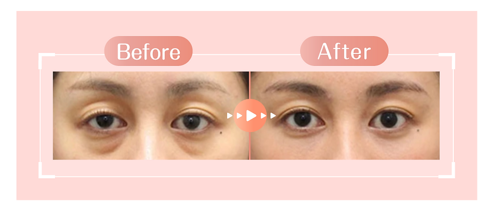 AE_20250807_Eye Fit_新 Landing2.png
