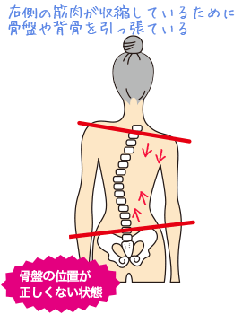 骨盤が歪むってどういうこと?いいえ、骨盤が歪むことはありません。(骨盤矯正その1)