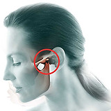 cirurgia-atm.jpg