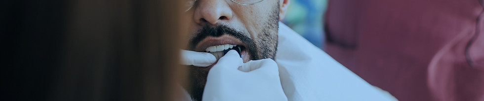 Precision-crafted zirconium crowns at Casas Clinics, showcasing durability and aesthetics.