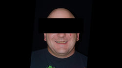 Zahnsanierung