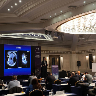  IVUS 