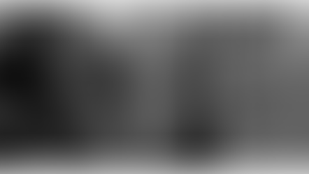 Mastering Precision: Unleash the Power of CT Evaluation for TAVI Success