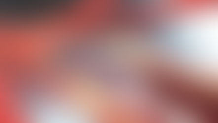 Unveiling the World of Coronary Artery Stents: Types, Advantages, and Considerations for Cardiologis