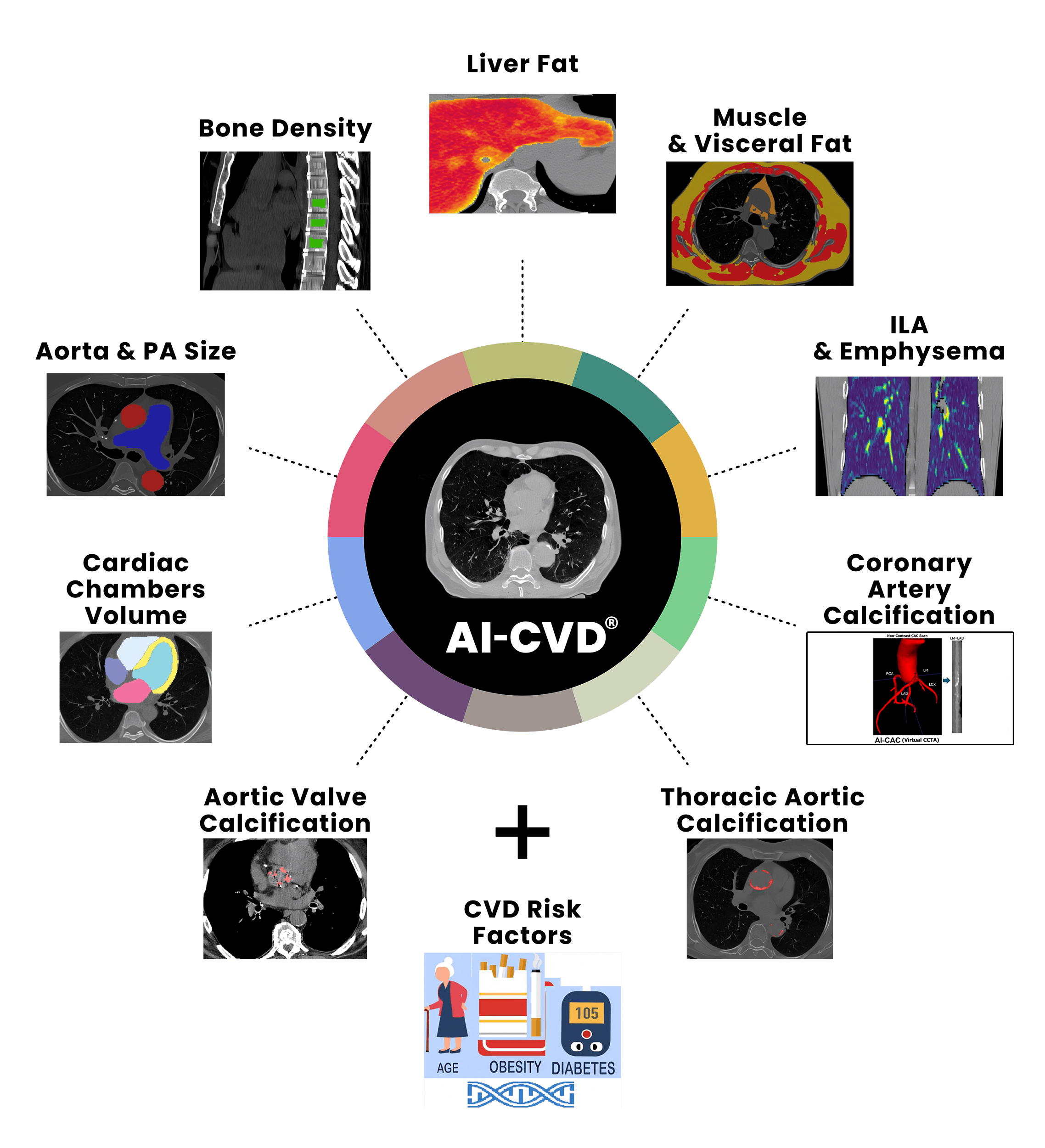 AI-CVD wheel graphic showing comprehensive cardiovascular risk analysis