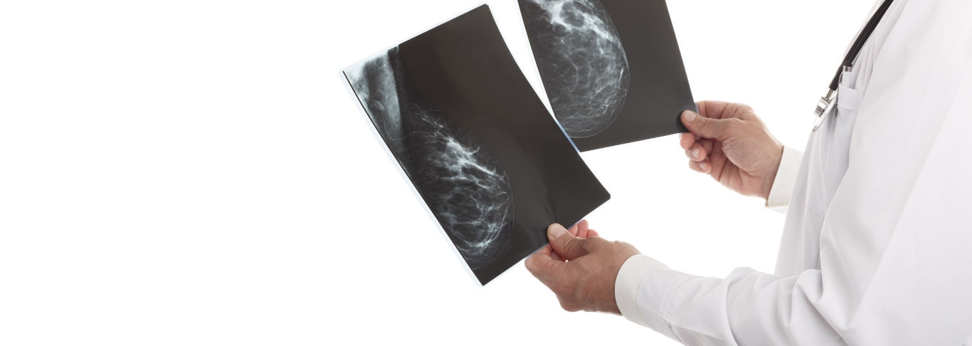 mamografia