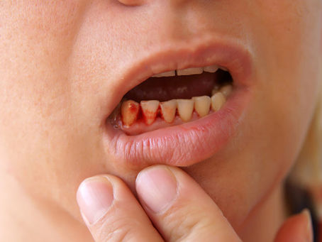 Navigating the Unexpected: What To Do When Dental Emergencies Happen in Ghatkopar, Mumbai