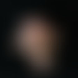 Gratin de topinambours Express