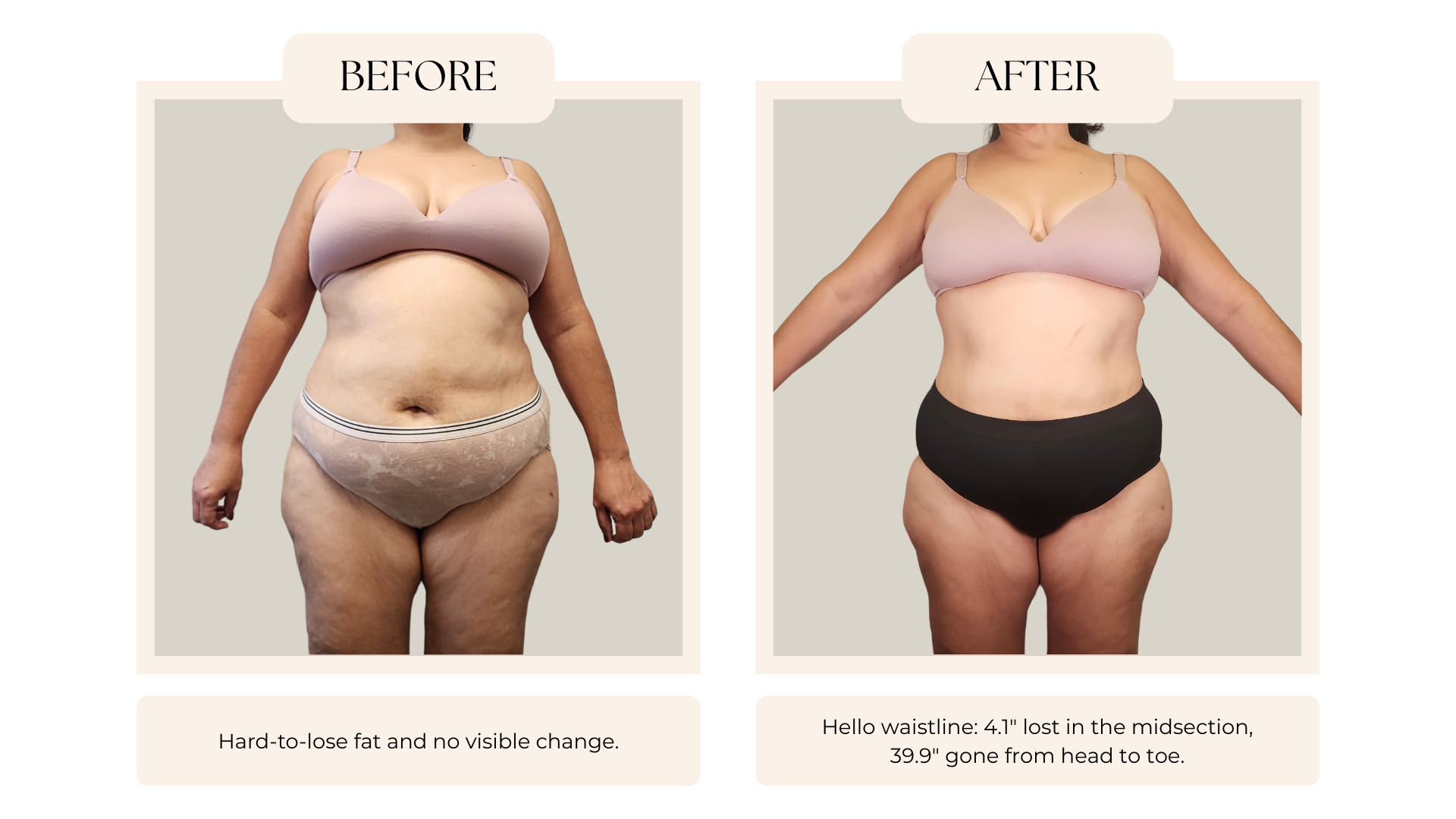 Laser Lipo Body Contouring.png