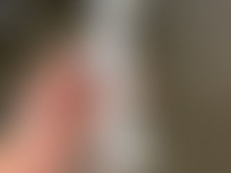 McLaren Inverted Brake Caliper Brackets 