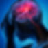 Botox for Migraine