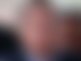 Bolsonaro será internado nesta 2ª feira para fazer novas cirurgias