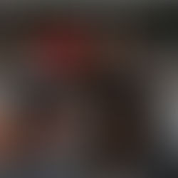 Acidentes com bicicleta elétrica explodem e acendem alerta no Rio