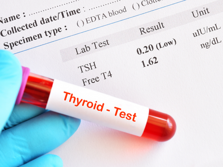 Thyroid blood test sample with TSH and Free T4 lab results, comprehensive thyroid panel explained at Willow Naturopathic, London Ontario