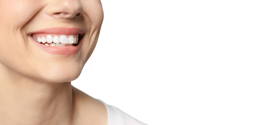 teeth-whitening-patient-smiling-1-removebg_edited.png