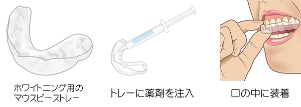 ホームブリーチ