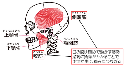 顎関節症1