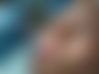 Beneficios de los hilos tensores PDO en la cara: tratamientos tensores faciales avanzados