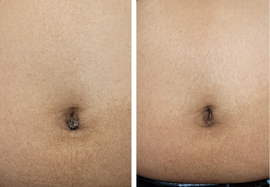 Before&After