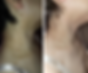 Before&After