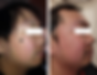 Before&After