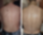 Before&After