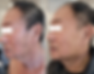 Before&After