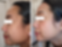 Before&After