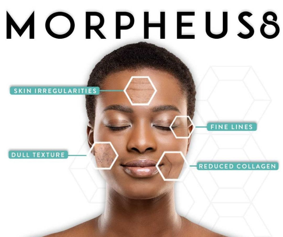Morpheus8 – Upper Arm