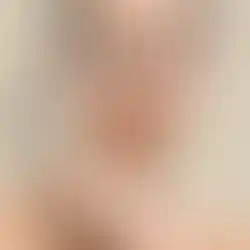 Eine Frau hat die sensitiven Augenpads aufgelegt