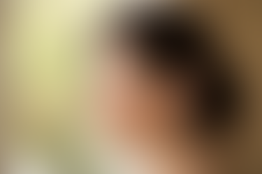 Warum SkinIdent einzigartig ist