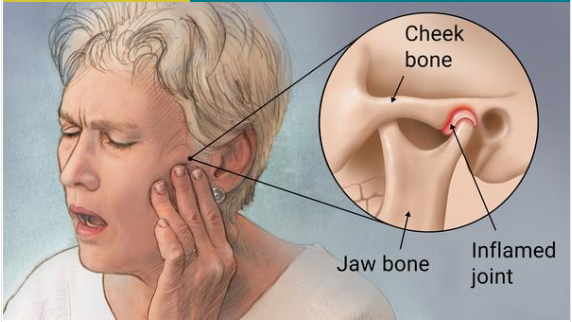 Temporomandibular Disorders top dentist in patna