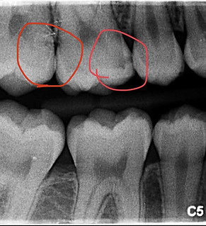 Dental X Ray.jpg