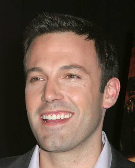 Close-up of Ben Affleck’s Hollywood smile after veneers, showcasing bright white teeth and a symmetrical look.