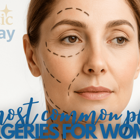Middle-aged woman with surgical guide lines on face symbolizing common plastic surgeries for women including facelift, deep plane facelift, neck lift, and blepharoplasty