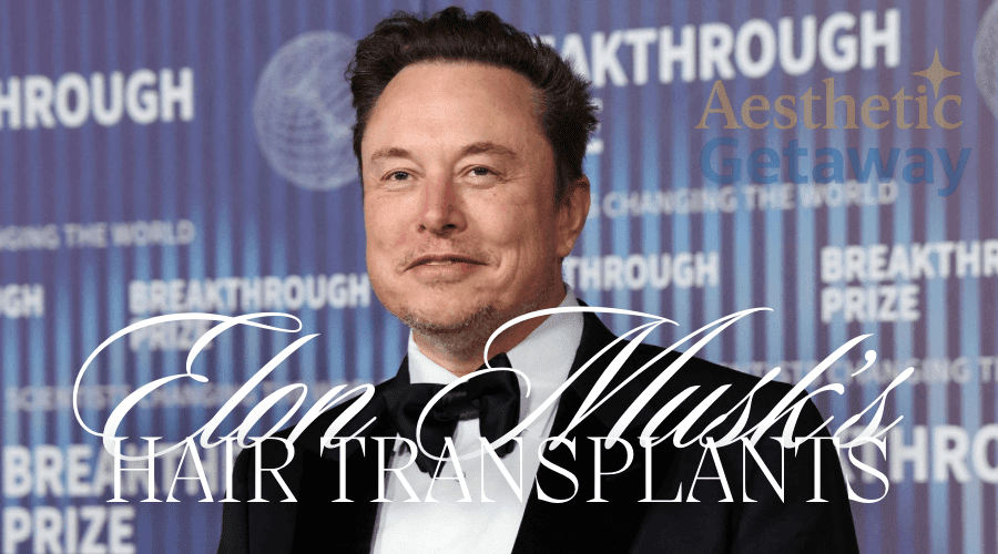 Elon Musk on the red carpet in a tuxedo, used as the cover image for his hair transplant transformation blog.