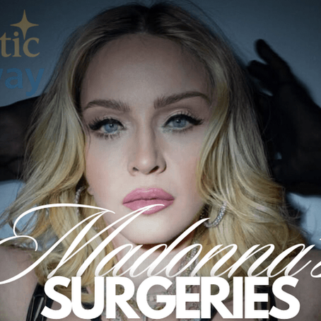 Close-up of Madonna with bold makeup, highlighting her rumored plastic surgeries including facelifts and fillers, Aesthetic Getaway blog cover.