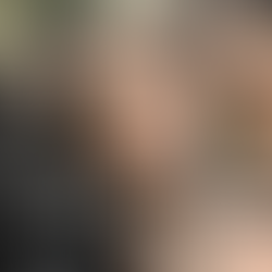 Demi Moore Plastic Surgery: Secrets Behind an Ageless Hollywood Icon