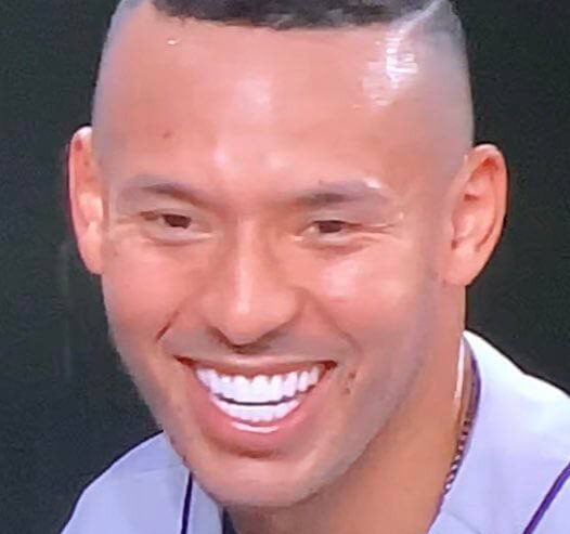 Carlos Correa showing wide, symmetrical smile likely rebuilt with cosmetic veneers or crowns after makeover