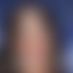 Megan Fox showcasing her perfect Hollywood smile after cosmetic dental veneers.