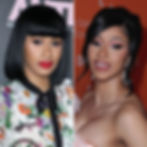 Cardi B before and after side-by-side comparison of fillers and nose surgery.